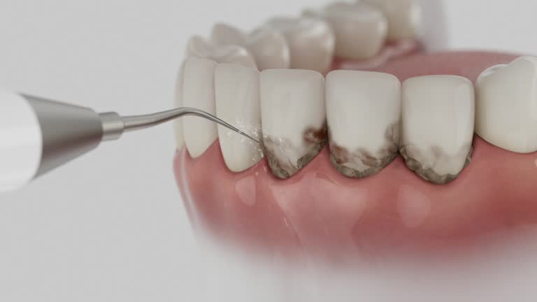Reliable Dental contractor in Santa Claus, IN by Dentist Open Now